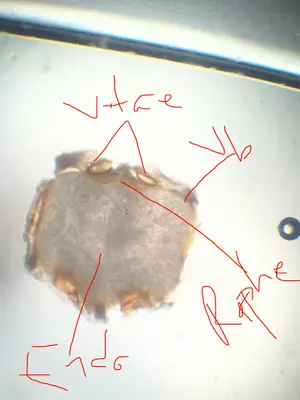 Microscopy of fennel