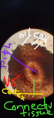 Clove oil glands 
the ones in the periphery