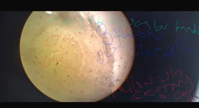 
Ginger cross section showing:
Ring of vascular bundles
Fibrous sheath 
Yellowish secretory oil cells